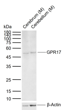 GPR17 Rabbit Polyclonal Antibody