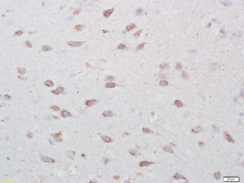 GPR177 Rabbit Polyclonal Antibody
