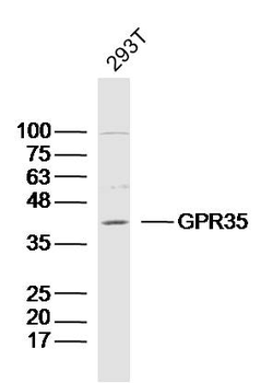 GPR35 Rabbit Polyclonal Antibody