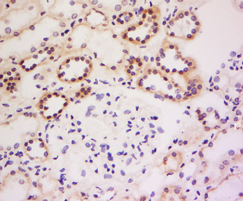 GRB 14 Rabbit Polyclonal Antibody