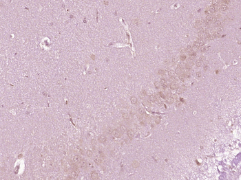 GRINA Rabbit Polyclonal Antibody