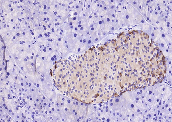 GSK3 Alpha + Beta Rabbit Polyclonal Antibody