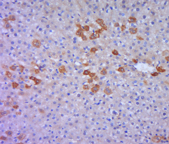 GSTT1 Rabbit Polyclonal Antibody
