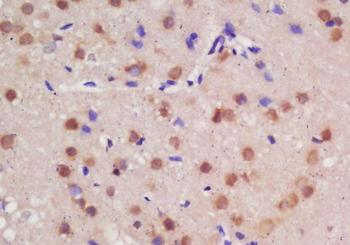 Guanylyl Cyclase alpha 1 Rabbit Polyclonal Antibody