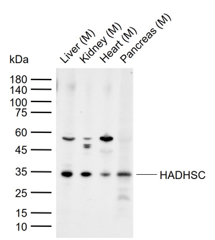 HADHSC Rabbit Polyclonal Antibody