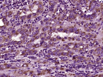 HAO1 Rabbit Polyclonal Antibody