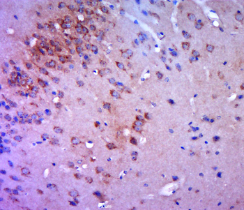 HCCS Rabbit Polyclonal Antibody