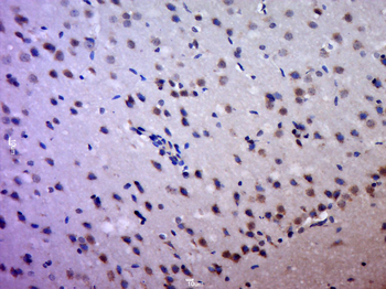 HCCS Rabbit Polyclonal Antibody