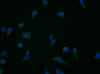 HECT E3 ubiquitin ligase Rabbit Polyclonal Antibody