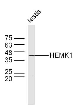 HEMK1 Rabbit Polyclonal Antibody
