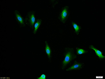 Phospho-HER2 (Tyr1221) Rabbit Polyclonal Antibody