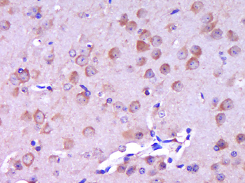 Phospho-HER4 (Tyr1258) Rabbit Polyclonal Antibody