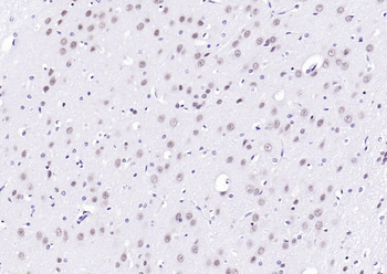 ErbB4 Rabbit Polyclonal Antibody