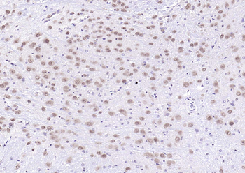 ErbB4 Rabbit Polyclonal Antibody