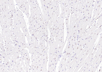 ErbB4 Rabbit Polyclonal Antibody