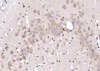 HERPUD1 Rabbit Polyclonal Antibody