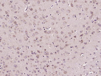 HES2 Rabbit Polyclonal Antibody