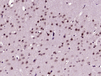 HES4 Rabbit Polyclonal Antibody