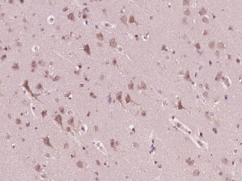 RAD23B Rabbit Polyclonal Antibody