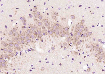 HIPPI Rabbit Polyclonal Antibody