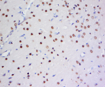 HSH2D Rabbit Polyclonal Antibody