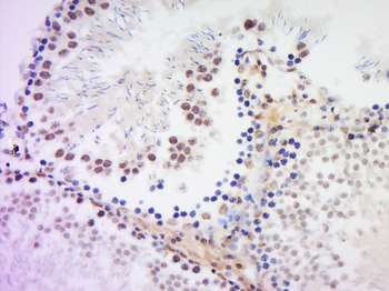 HSH2D Rabbit Polyclonal Antibody