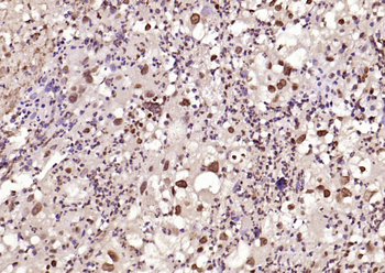 Phospho-HSP70 (Tyr611) Rabbit Polyclonal Antibody
