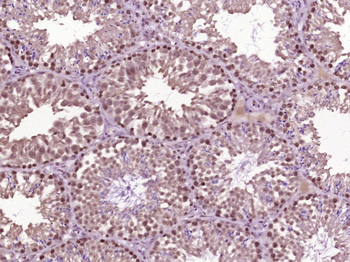 HSP70 Rabbit Polyclonal Antibody