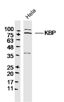 KBP Rabbit Polyclonal Antibody