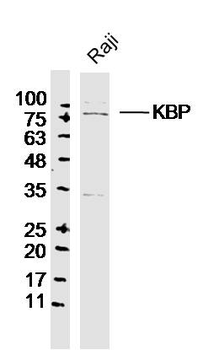 KBP Rabbit Polyclonal Antibody