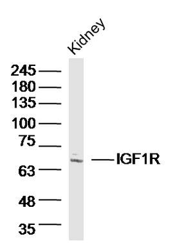 IGF1R Rabbit Polyclonal Antibody