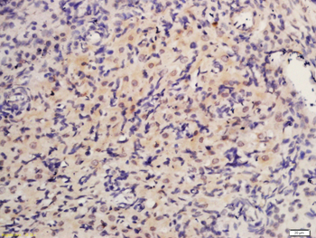 Inhibin Alpha Rabbit Polyclonal Antibody