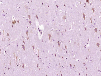 IRE1 Rabbit Polyclonal Antibody