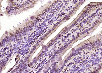 IRX1 Rabbit Polyclonal Antibody