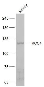 KCC4 Rabbit Polyclonal Antibody