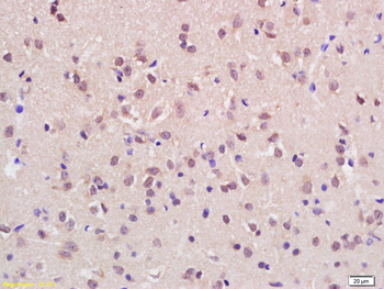 ASH1L Rabbit Polyclonal Antibody