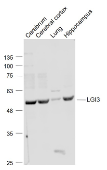 LGI3 Rabbit Polyclonal Antibody