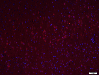 LIM kinase 1 + 2 Rabbit Polyclonal Antibody
