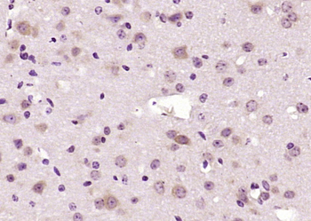 LZIC Rabbit Polyclonal Antibody