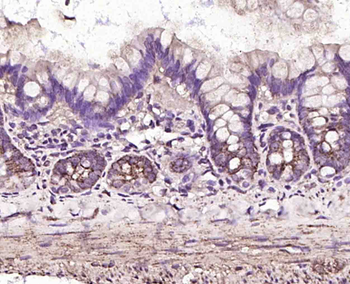 Monoamine Oxidase B Rabbit Polyclonal Antibody