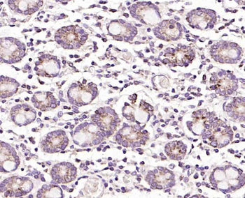 Monoamine Oxidase B Rabbit Polyclonal Antibody