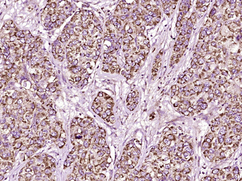 Monoamine Oxidase B Rabbit Polyclonal Antibody