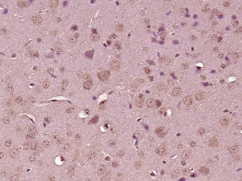 MAPK6 Rabbit Polyclonal Antibody
