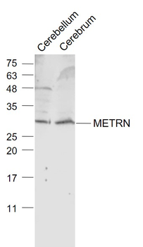 METRN Rabbit Polyclonal Antibody