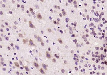 Microcephalin 1/BRIT1 Rabbit Polyclonal Antibody