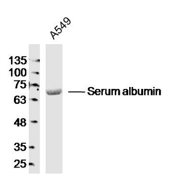 Albumin Rabbit Polyclonal Antibody