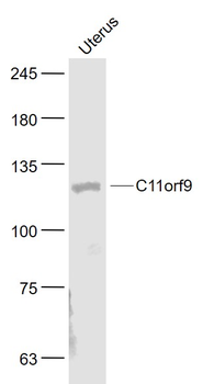MRF/C11orf9 Rabbit Polyclonal Antibody