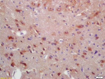 MRF/C11orf9 Rabbit Polyclonal Antibody