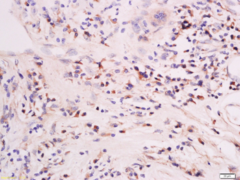 Mst2 Rabbit Polyclonal Antibody