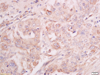 Mst2 Rabbit Polyclonal Antibody